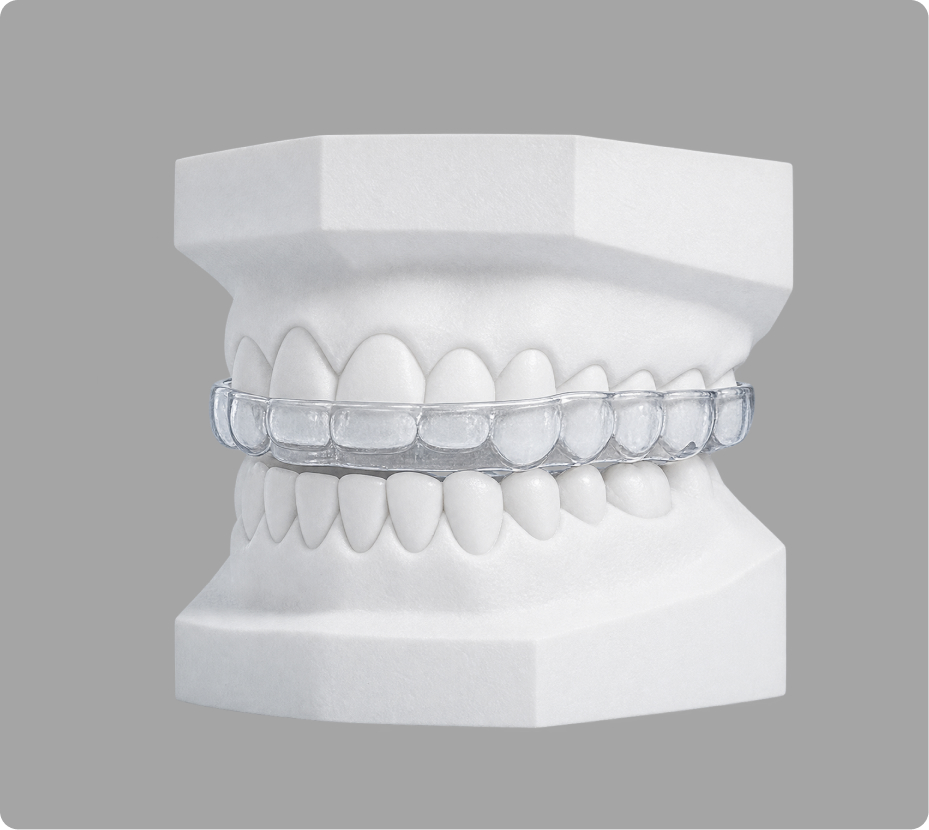 DENTURE DESIGN — an example of Geny design work